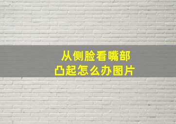 从侧脸看嘴部凸起怎么办图片