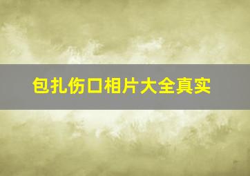 包扎伤口相片大全真实