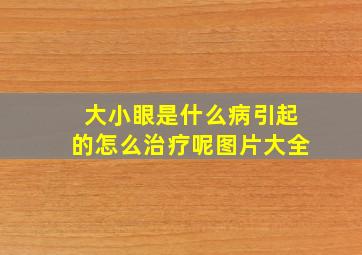 大小眼是什么病引起的怎么治疗呢图片大全