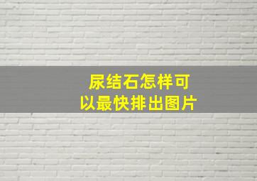 尿结石怎样可以最快排出图片