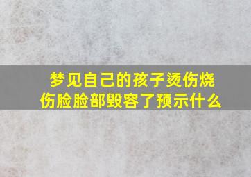 梦见自己的孩子烫伤烧伤脸脸部毁容了预示什么