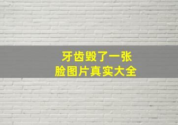 牙齿毁了一张脸图片真实大全