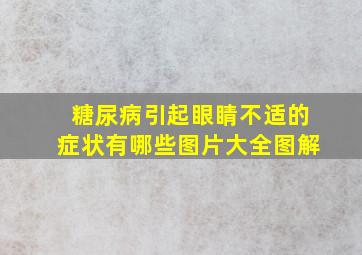 糖尿病引起眼睛不适的症状有哪些图片大全图解